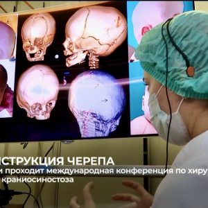 В Тюмени проходит международная конференция по хирургическому лечению краниосиностоза